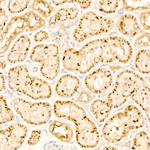 beta Galactosidase Antibody in Immunohistochemistry (Paraffin) (IHC (P))