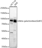 beta Galactosidase Antibody in Western Blot (WB)