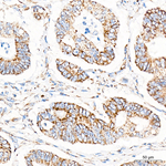 SLC25A13 Recombinant Rabbit Monoclonal Antibody (9L4I7)