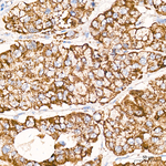 SLC25A13 Antibody in Immunohistochemistry (Paraffin) (IHC (P))