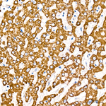 SLC25A13 Antibody in Immunohistochemistry (Paraffin) (IHC (P))