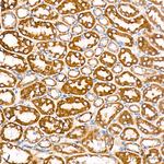 SLC25A13 Antibody in Immunohistochemistry (Paraffin) (IHC (P))