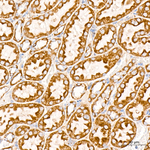 SLC25A13 Antibody in Immunohistochemistry (Paraffin) (IHC (P))