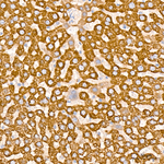 SLC25A13 Antibody in Immunohistochemistry (Paraffin) (IHC (P))