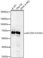 SLC25A13 Antibody in Western Blot (WB)