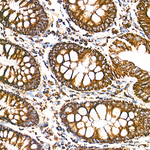 COX5B Antibody in Immunohistochemistry (Paraffin) (IHC (P))
