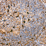 LGMN Antibody in Immunohistochemistry (Paraffin) (IHC (P))