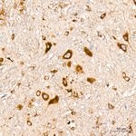 LGMN Antibody in Immunohistochemistry (Paraffin) (IHC (P))