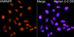hnRNP F Antibody in Immunocytochemistry (ICC/IF)