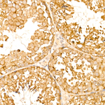 TOLLIP Recombinant Rabbit Monoclonal Antibody (6L9Z2)