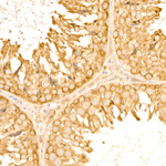 TOLLIP Antibody in Immunohistochemistry (Paraffin) (IHC (P))
