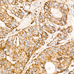 BCAT2 Antibody in Immunohistochemistry (Paraffin) (IHC (P))