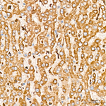 BCAT2 Antibody in Immunohistochemistry (Paraffin) (IHC (P))