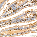 BCAT2 Antibody in Immunohistochemistry (Paraffin) (IHC (P))