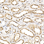 DDX3/DDX3Y Antibody in Immunohistochemistry (Paraffin) (IHC (P))