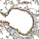 DDX3/DDX3Y Antibody in Immunohistochemistry (Paraffin) (IHC (P))