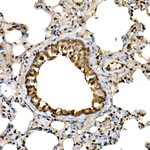 DDX3/DDX3Y Antibody in Immunohistochemistry (Paraffin) (IHC (P))