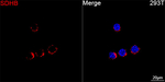 SDHB Antibody in Immunocytochemistry (ICC/IF)