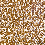 SDHB Antibody in Immunohistochemistry (Paraffin) (IHC (P))
