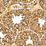 SDHB Antibody in Immunohistochemistry (Paraffin) (IHC (P))