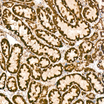 SDHB Antibody in Immunohistochemistry (Paraffin) (IHC (P))