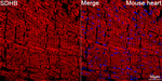 SDHB Antibody in Immunohistochemistry (Paraffin) (IHC (P))