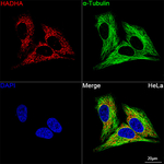 HADHA Antibody in Immunocytochemistry (ICC/IF)