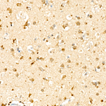 ASM Antibody in Immunohistochemistry (Paraffin) (IHC (P))