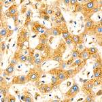 ASM Recombinant Rabbit Monoclonal Antibody (2H5Q0)