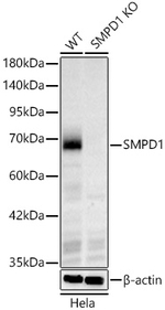 ASM Antibody in Western Blot (WB)