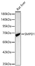 ASM Antibody in Western Blot (WB)