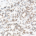 HSF1 Antibody in Immunohistochemistry (Paraffin) (IHC (P))
