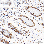 HSF1 Antibody in Immunohistochemistry (Paraffin) (IHC (P))