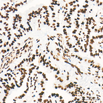 HSF1 Recombinant Rabbit Monoclonal Antibody (5V4U6)