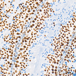 HSF1 Antibody in Immunohistochemistry (Paraffin) (IHC (P))