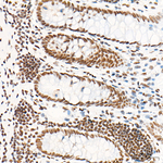 HSF1 Antibody in Immunohistochemistry (Paraffin) (IHC (P))