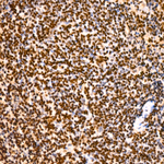 LIMK1 Antibody in Immunohistochemistry (Paraffin) (IHC (P))