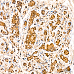 LIMK1 Antibody in Immunohistochemistry (Paraffin) (IHC (P))