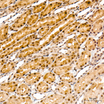 LIMK1 Recombinant Rabbit Monoclonal Antibody (3U3Q8)
