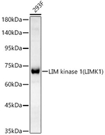LIMK1 Antibody in Western Blot (WB)