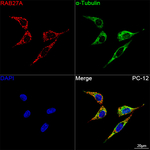 RAB27A Antibody in Immunocytochemistry (ICC/IF)