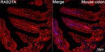 RAB27A Antibody in Immunohistochemistry (Paraffin) (IHC (P))