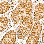 RAB27A Antibody in Immunohistochemistry (Paraffin) (IHC (P))