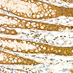 RAB27A Antibody in Immunohistochemistry (Paraffin) (IHC (P))