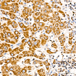RAB27A Antibody in Immunohistochemistry (Paraffin) (IHC (P))