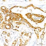RAB27A Antibody in Immunohistochemistry (Paraffin) (IHC (P))