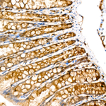 RAB27A Antibody in Immunohistochemistry (Paraffin) (IHC (P))