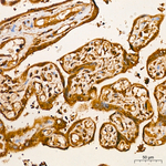 AKT2 Antibody in Immunohistochemistry (Paraffin) (IHC (P))
