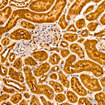 AKT2 Antibody in Immunohistochemistry (Paraffin) (IHC (P))