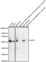 AKT2 Antibody in Western Blot (WB)